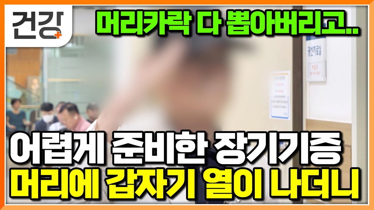 장기기증하려다 알게 된 두피 지루성 피부염, 머리 긁다 상처까지 난 이유와 해결책 알아보자│명의│#EBS건강