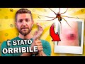 Morso da un ragno violino - Ho quasi perso il braccio
