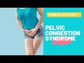 Pelvic Congestion Syndrome or Pelvic Venous Insufficiency - Treatment with Embolization