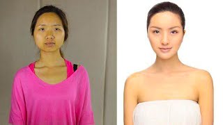 Fascinating Facts About Plastic Surgery
