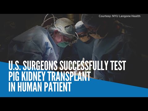 US surgeons successfully test pig kidney transplant in human patient