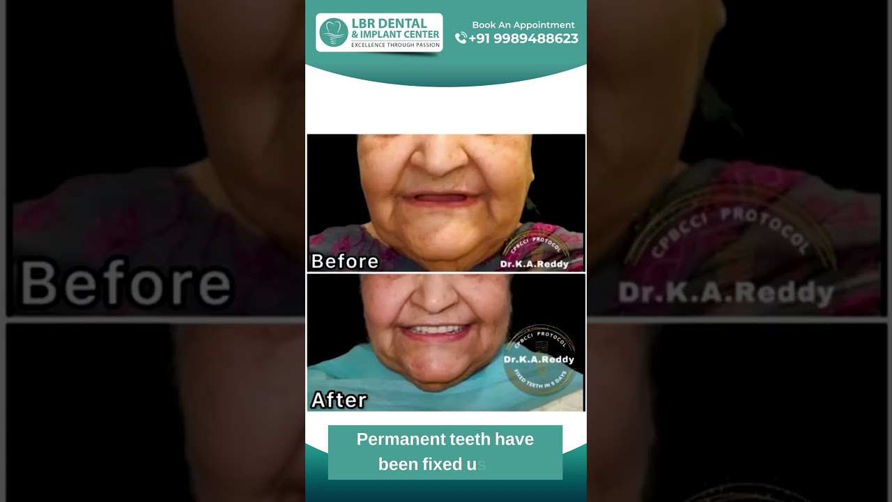 Avoid These Common Mistakes When Getting Affordable Dental Implants