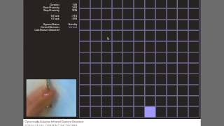 EDEN | Differential Infrared Gesture Detection
