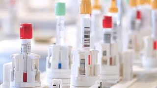 Beckman Coulter’s Total Lab Automation (TLA)