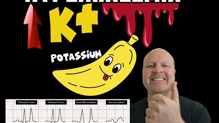 Why Hyperkalemia causes a widened QRS complex on the ECG : Explained