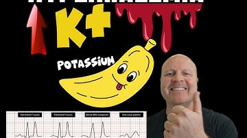 Why Hyperkalemia causes a widened QRS complex on the ECG : Explained