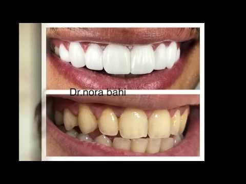 صفوة المهيدب لطب الأسنان