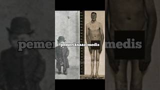 Manusia Yang Menjadi Kurcaci Dan Raksasa shorts