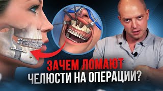 картинка: Как исправляют прикус хирургическим путем? Ортогнатическая хирургия.
