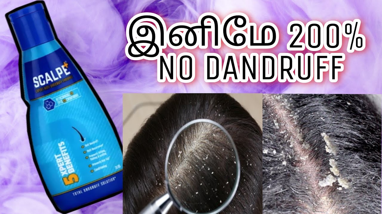 Best Dandruff shampoo in Tamil Scalpe dandruff shampoo review honest in tamil YouTube