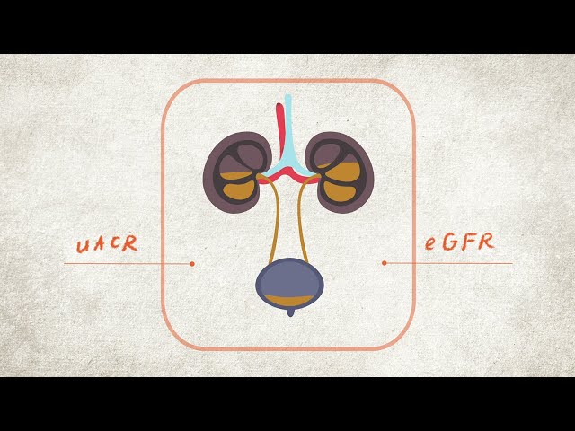 What are your Kidney Numbers? uACR and eGFR Explained | CKD Heat Map | NKF class=
