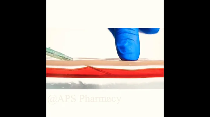 IV Insertion Angle😳😳 #shorts #viral #medical #medicalstudent #youtubeshorts #pharmacy