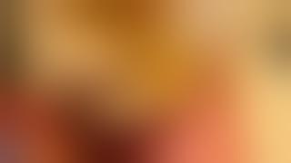 WAW DUO FUE SYSTEM #hairtransplant surgery