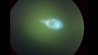 VIDEO 8  Dactylochlamys pisciformis VB2A methanogens, autofluorescence