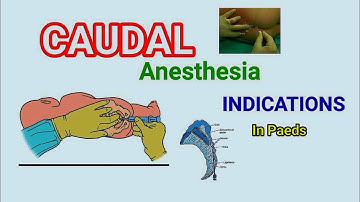 Caudal block and it