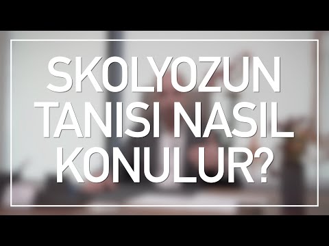 Skolyoz Tanısı Röntgenle mi Konulur? Skolyoz Tanısı!