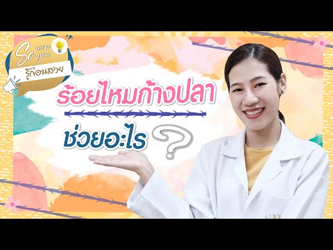 ร้อยไหมก้างปลา ช่วยอะไร? I SowonSoyou EP.28