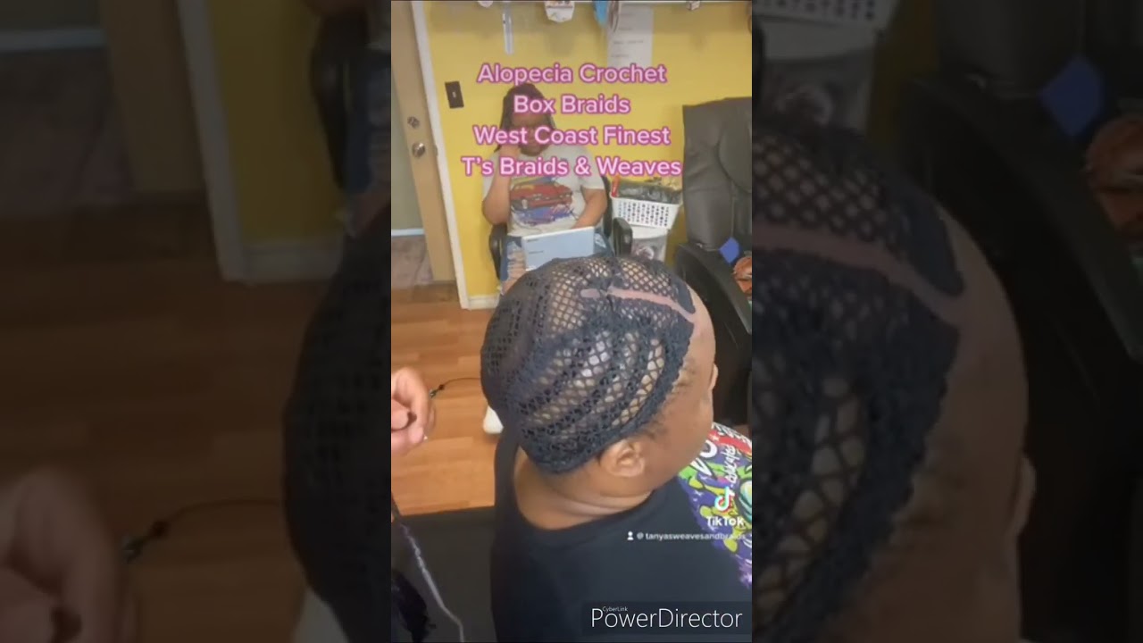 ALOPECIA CROCHET BOX BRAIDS WITH LACE PART CAP