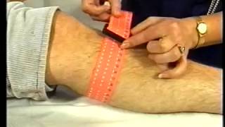 Tubigrip vs flat bandage 1987