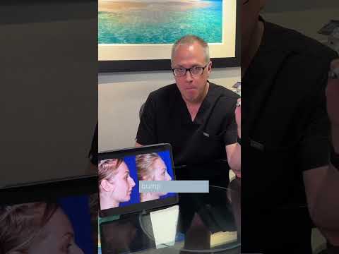 Video thumbnail: Nose Fillers Yay or Nay? Dr Morin Shares His Insights · Robert Morin MD