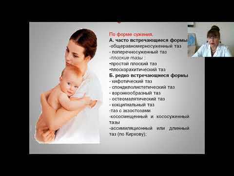 Узкий таз в акушерстве  - лекция по акушерству и гинекологии (докт.мед.наук, профессор Т.Г.Денисова)