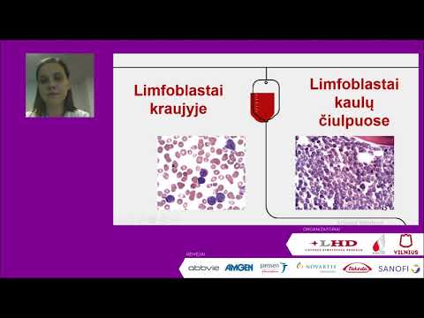 Ūminė limfoleukemija: diagnostika, gydymo būdai ir stebėsena.