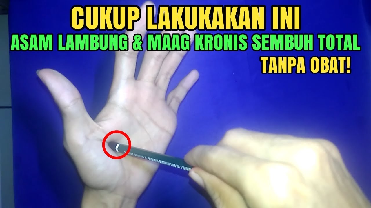 Penyakit Maagh Kronis Obat Herbal Penyakit Maag Akut