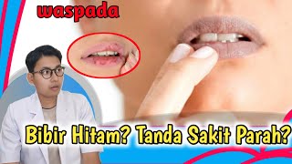 Penyakit Yang Bisa Menyebabkan BIBIR Menjadi HITAM dan GELAP || dr. Andi Septiawan