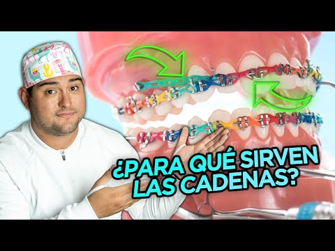 Video: ¿Para qué se utilizan las cadenas de consulta?