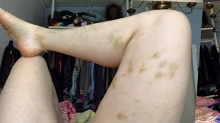 Celebrity Comedian Opens Up About Domestic Violence With Shocking Instagram Post Wealth