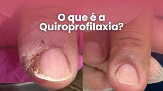 Quiroprofilaxia