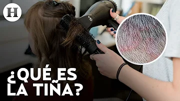 ¿Cómo deshacerse de las bacterias en el cuero cabelludo?