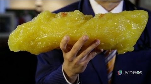 Dr. Juan Rivera nos muestra lo que representan 5 libras de grasa en nuestro cuerpo