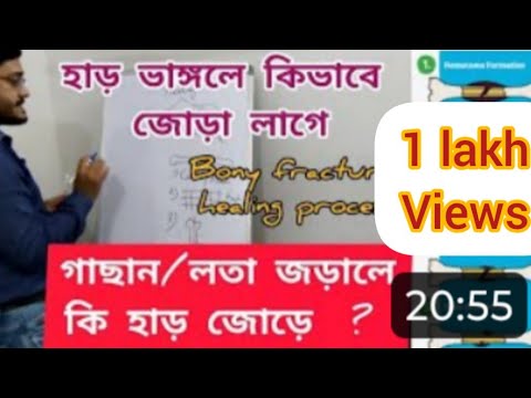 ভিডিও: একটি বাকল ফ্র্যাকচার হয়?