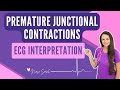 Premature Junctional Contractions Quiz