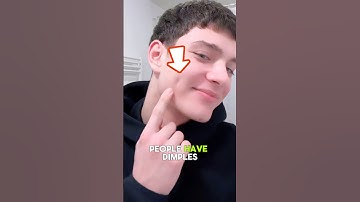 Why Do Some People Have Dimples When They Smile?