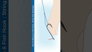 How To Remove A Fish Hook String Yank Technique