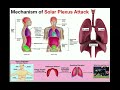 Mechanism of the Solar Plexus Attack | Getting the Wind Knocked Out of You