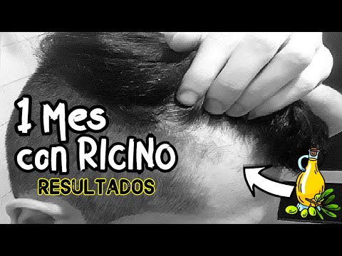 Vídeo: Aceite De Ricino Para El Crecimiento De La Barba Y Otros Beneficios Para El Cabello: ¿funciona?