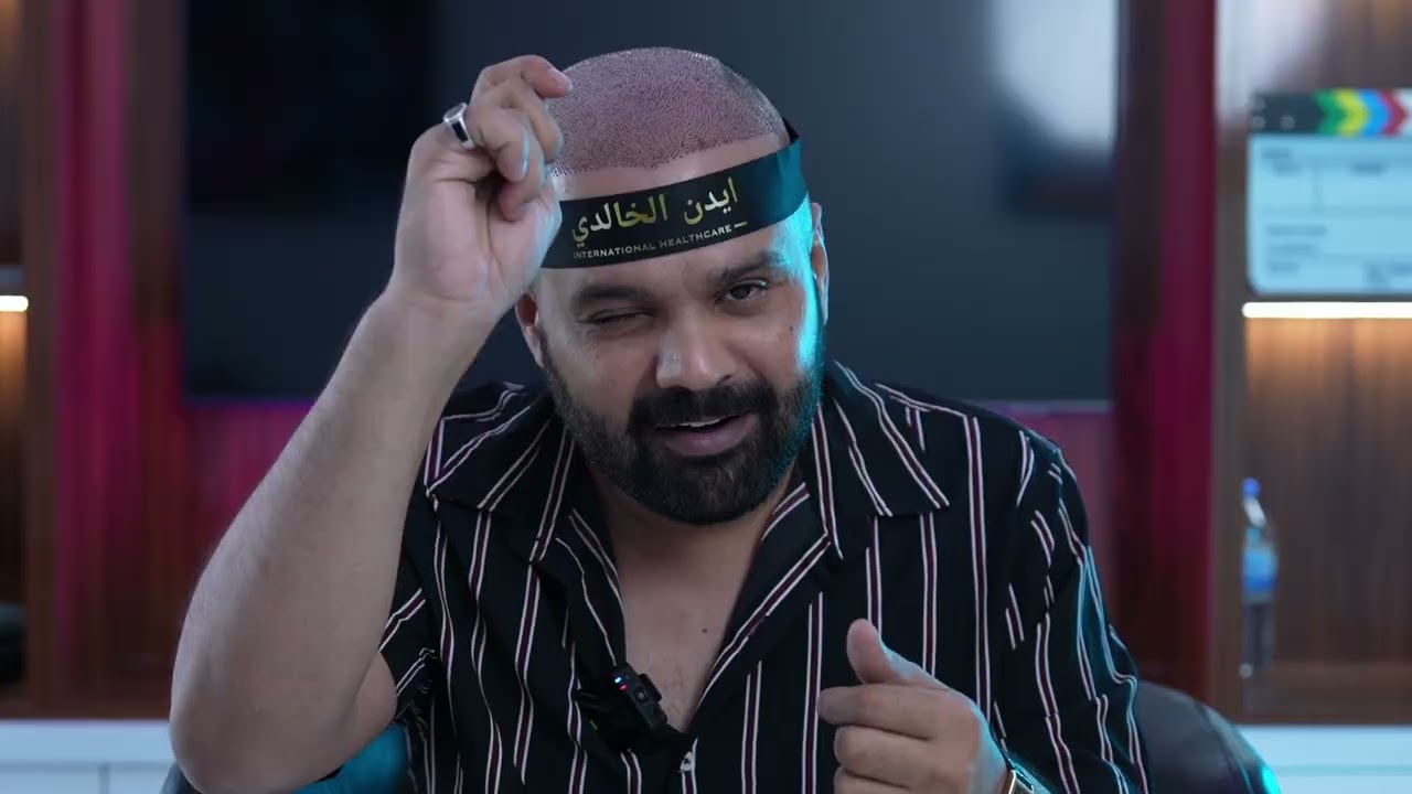 ‏ايدن الخالدي زراعة الشعر زراعة الدقن