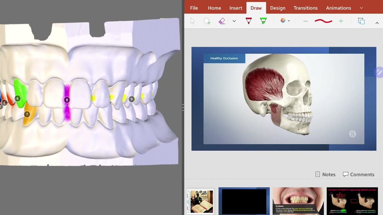 30-  Dental Occlusion P2 | الجزء 2 من الأوكلوجن