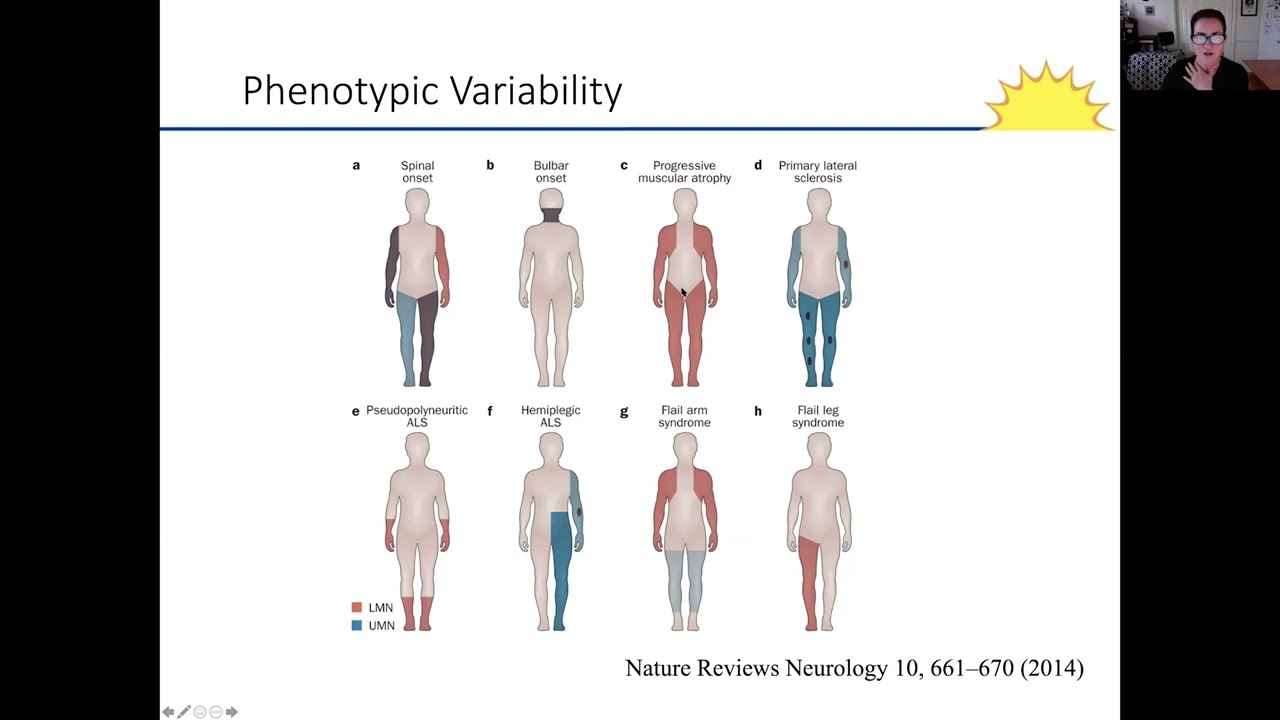 Physical Therapy and ALS.  Presented by Sara Feldman