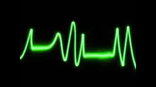 Showtek   Down Under