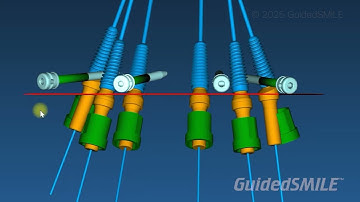 Why Use RealGUIDE Software? - Aesthetics Marketing