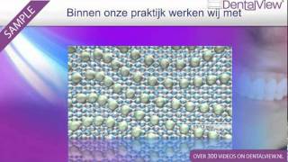 StraumannSLAactive