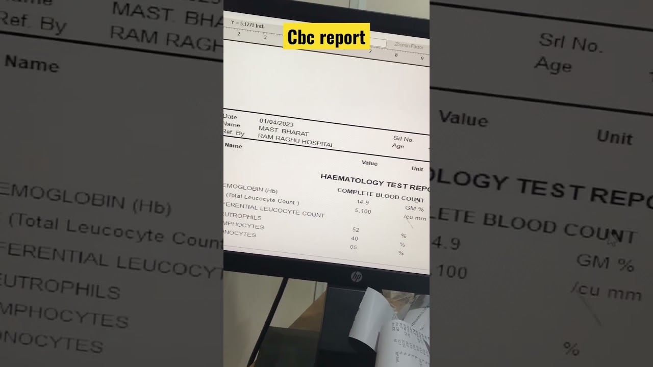 READY TO PRINT CBC REPORT 