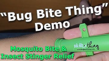 “Bug Bite Thing” Demo: Mosquito Bite & Insect Stinger Relief (Chemical-Free!)