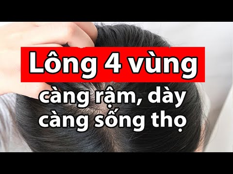 Video Bất Kể Đàn Ông Hay Phụ Nữ, Lông 4 Vùng Này Càng Rậm... - youtube
