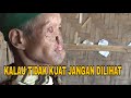 DERITA YANG TAK BERUJUNG...!!! KAKEK PENYANDANG KANKER. Membuat netizen menangis