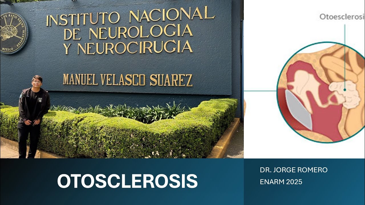 OTOSCLEROSIS // ENARM 2025 // GPC